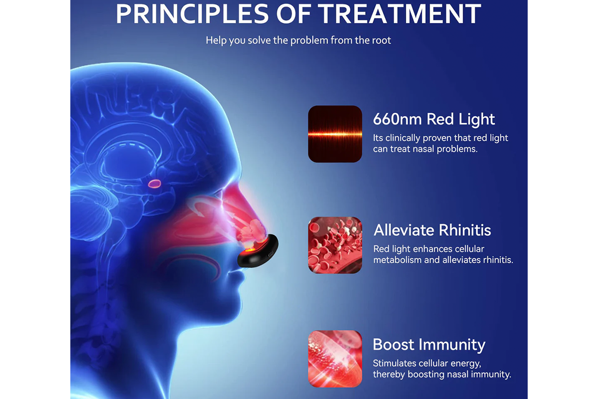 Red light therapy device: a new dawn for rhinitis treatment