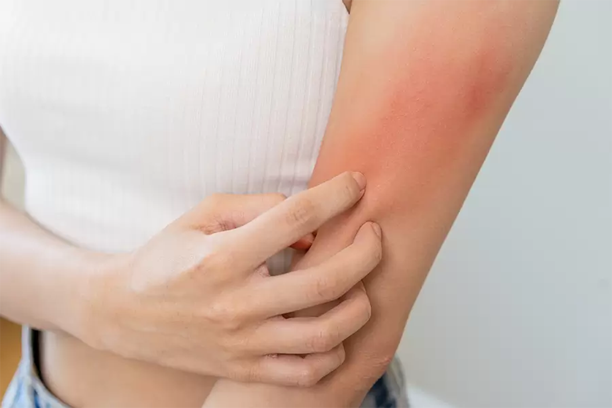 Phototherapy helps reduce chronic, inflammatory skin conditions. Could it be right for you?